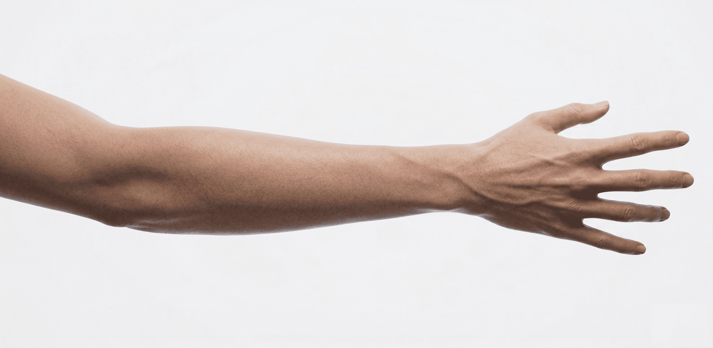Arm